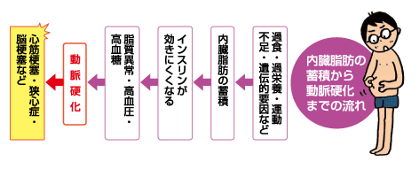 内臓脂肪の蓄積から動脈硬化までの流れ　過食・過栄養・運動不足・遺伝的要因など→内臓脂肪の蓄積→インスリンが効きにくくなる→脂質異常・高血圧・高血糖→動脈硬化→心筋梗塞・狭心症・脳梗塞など