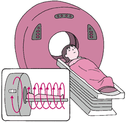 CT(コンピュータ断層撮影)検査