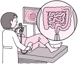 下部消化管(大腸)内視鏡検査(大腸ファイバースコープ検査)