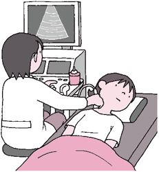 頸動脈超音波検査(頸部血管エコー)