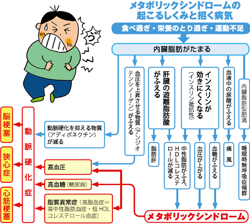 メタボリックシンドロームの起こるしくみと招く病気