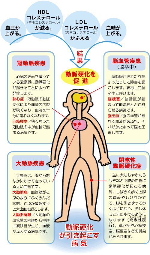 動脈硬化が引き起こす病気